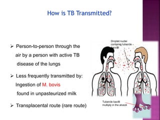  Person-to-person through the
air by a person with active TB
disease of the lungs
 Less frequently transmitted by:
Ingestion of M. bovis
found in unpasteurized milk
 Transplacental route (rare route)
How is TB Transmitted?
Droplet nuclei
containig tubercle
baccilli
Tubercle bacilli
multiply in the alveoli
 