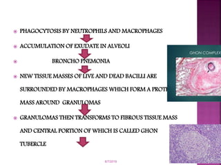  PHAGOCYTOSIS BY NEUTROPHILS AND MACROPHAGES
 ACCUMULATION OF EXUDATE IN ALVEOLI
 BRONCHO PNEMONIA
 NEW TISSUE MASSES OF LIVE AND DEAD BACILLI ARE
SURROUNDED BY MACROPHAGES WHICH FORM A PROTECTIVE
MASS AROUND GRANULOMAS
 GRANULOMAS THEN TRANSFORMS TO FIBROUS TISSUE MASS
AND CENTRAL PORTION OF WHICH IS CALLED GHON
TUBERCLE
6/7/2019
 