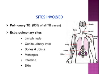  Pulmonary TB (85% of all TB cases)
 Extra-pulmonary sites
• Lymph node
• Genito-urinary tract
• Bones & Joints
• Meninges
• Intestine
• Skin
SITES INVOLVED
Kidney
Brain
Bone
Larynx
Lymph
node
Lung
Spine
 
