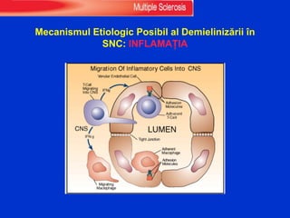 Mecanismul Etiologic Posibil al Demielinizării în
SNC: INFLAMAȚIA
 