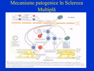 Mecanisme patogenice în Scleroza
Multiplă
 