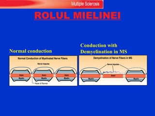 ROLUL MIELINEI
Normal conduction
Conduction with
Demyelination in MS
 