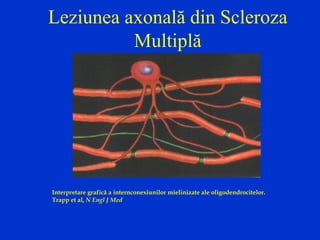 Leziunea axonală din Scleroza
Multiplă
Interpretare grafică a internconexiunilor mielinizate ale oligodendrocitelor.
Trapp et al, N Engl J Med
 