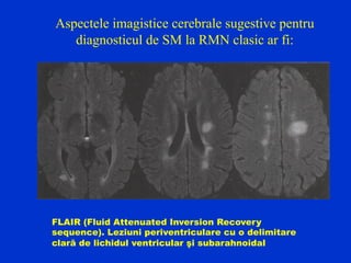 Aspectele imagistice cerebrale sugestive pentru
diagnosticul de SM la RMN clasic ar fi:
FLAIR (Fluid Attenuated Inversion Recovery
sequence). Leziuni periventriculare cu o delimitare
clară de lichidul ventricular şi subarahnoidal
 