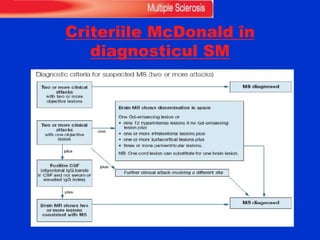 Criteriile McDonald în
diagnosticul SM
 