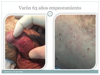 Varón 63 años empeoramiento
3

Sesiones, CS San Blas

 