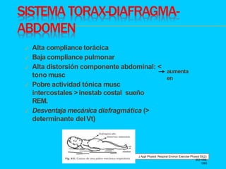 SISTEMA TORAX-DIAFRAGMA-
ABDOMEN
aumenta
en
J Appl Physiol: Respirat Environ Exercise Physiol 55(2):
353¬358,
1983
✓ Alta ...
