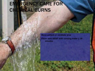 13 soft tissue_injuries