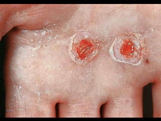 13 soft tissue_injuries