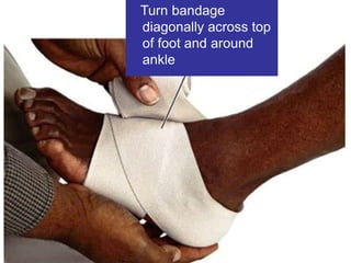 13 soft tissue_injuries