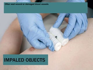 13 soft tissue_injuries