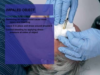 13 soft tissue_injuries