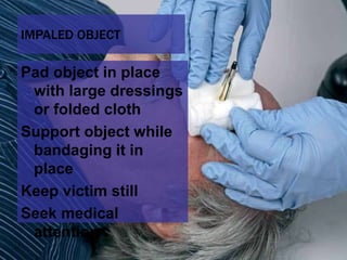 13 soft tissue_injuries