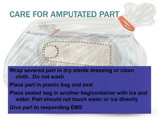 13 soft tissue_injuries