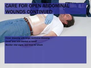 13 soft tissue_injuries