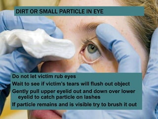 13 soft tissue_injuries