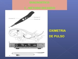 DIAGNOSTICO:
1 .-MÉTODO INVASIVO
OXIMETRIA
DE PULSO
 