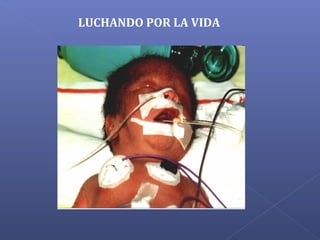LUCHANDO POR LA VIDA
 
