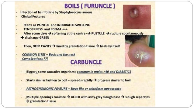 13 Surgical Infections of the Skin and Subcutaneous Tissues.pptx | Skin ...