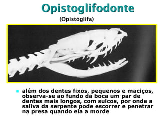 Opistoglifodonte
 além dos dentes fixos, pequenos e maciços,
observa-se ao fundo da boca um par de
dentes mais longos, com sulcos, por onde a
saliva da serpente pode escorrer e penetrar
na presa quando ela a morde
(Opistóglifa)
 
