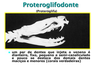Proteroglifodonte
 um par de dentes que injeta o veneno é
dianteiro, fixo, pequeno e semi-canaliculado
e pouco se destaca dos demais dentes
maciços e menores (corais verdadeiras)
(Proteróglifa)
 