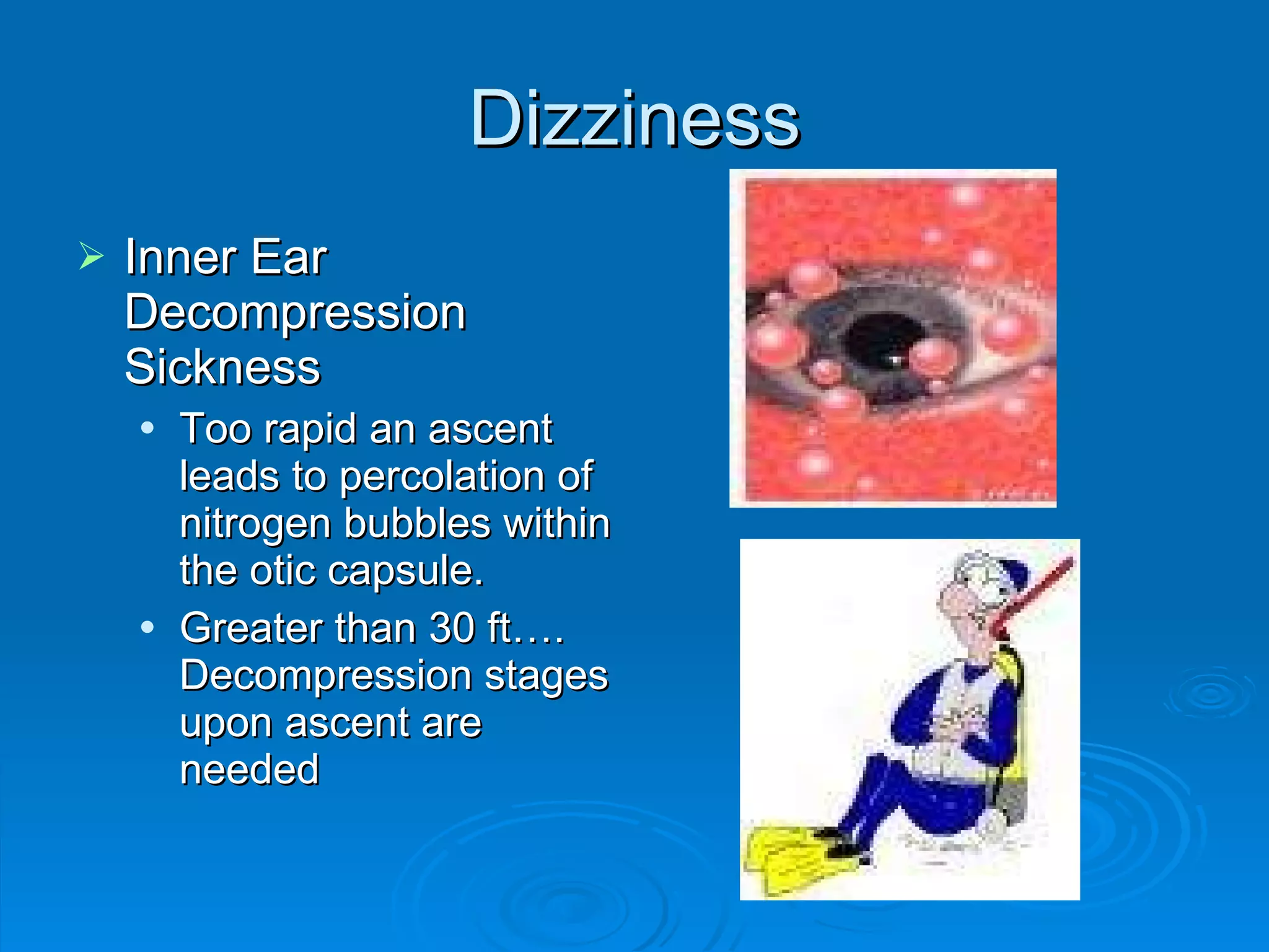 Dizziness Inner Ear Decompression Sickness Too rapid an ascent leads to percolation of nitrogen bubbles within the otic capsule. Greater than 30 ft…. Decompression stages upon ascent are needed 