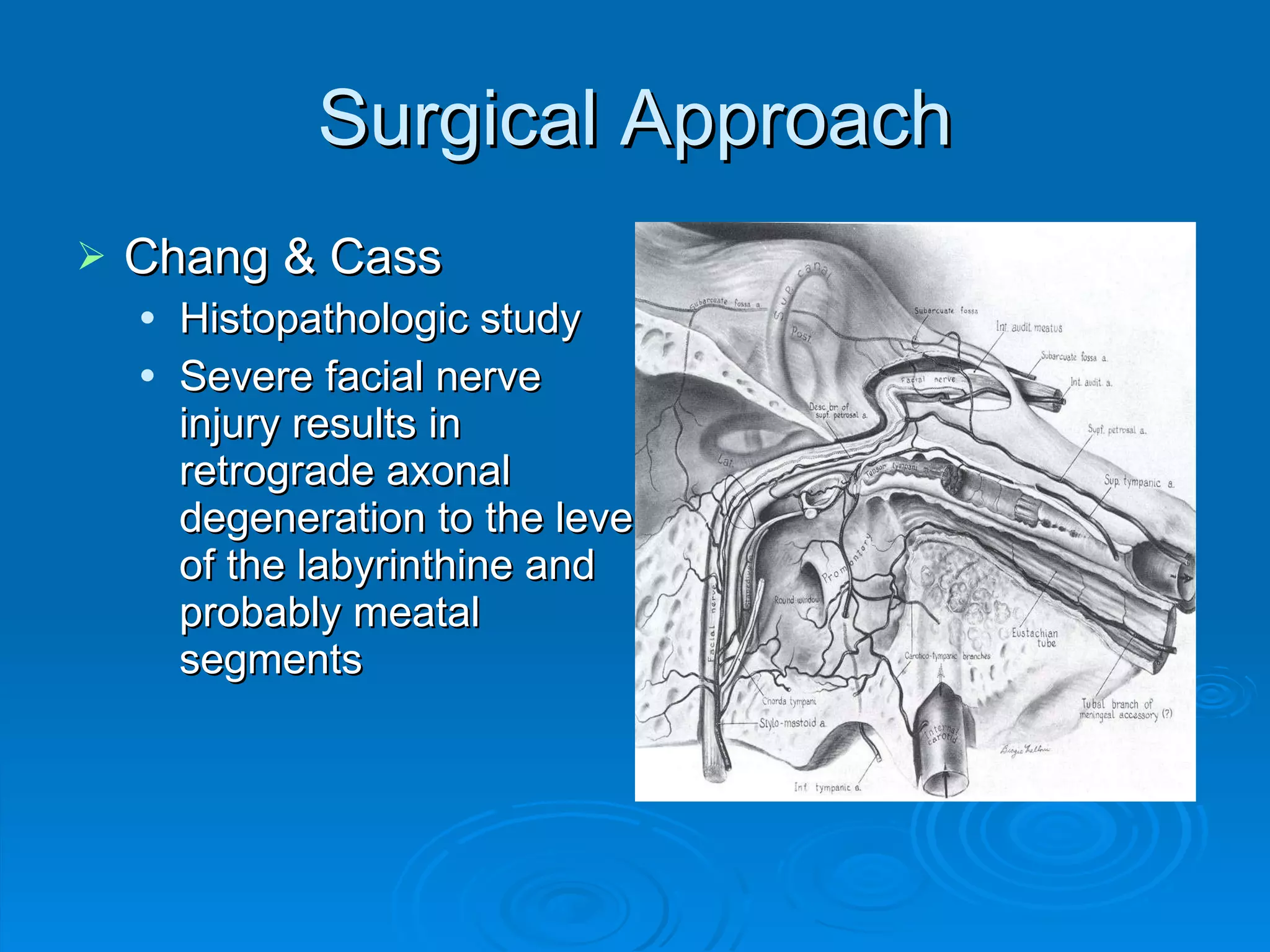 Surgical Approach Chang & Cass Histopathologic study Severe facial nerve injury results in retrograde axonal degeneration to the level of the labyrinthine and probably meatal segments 