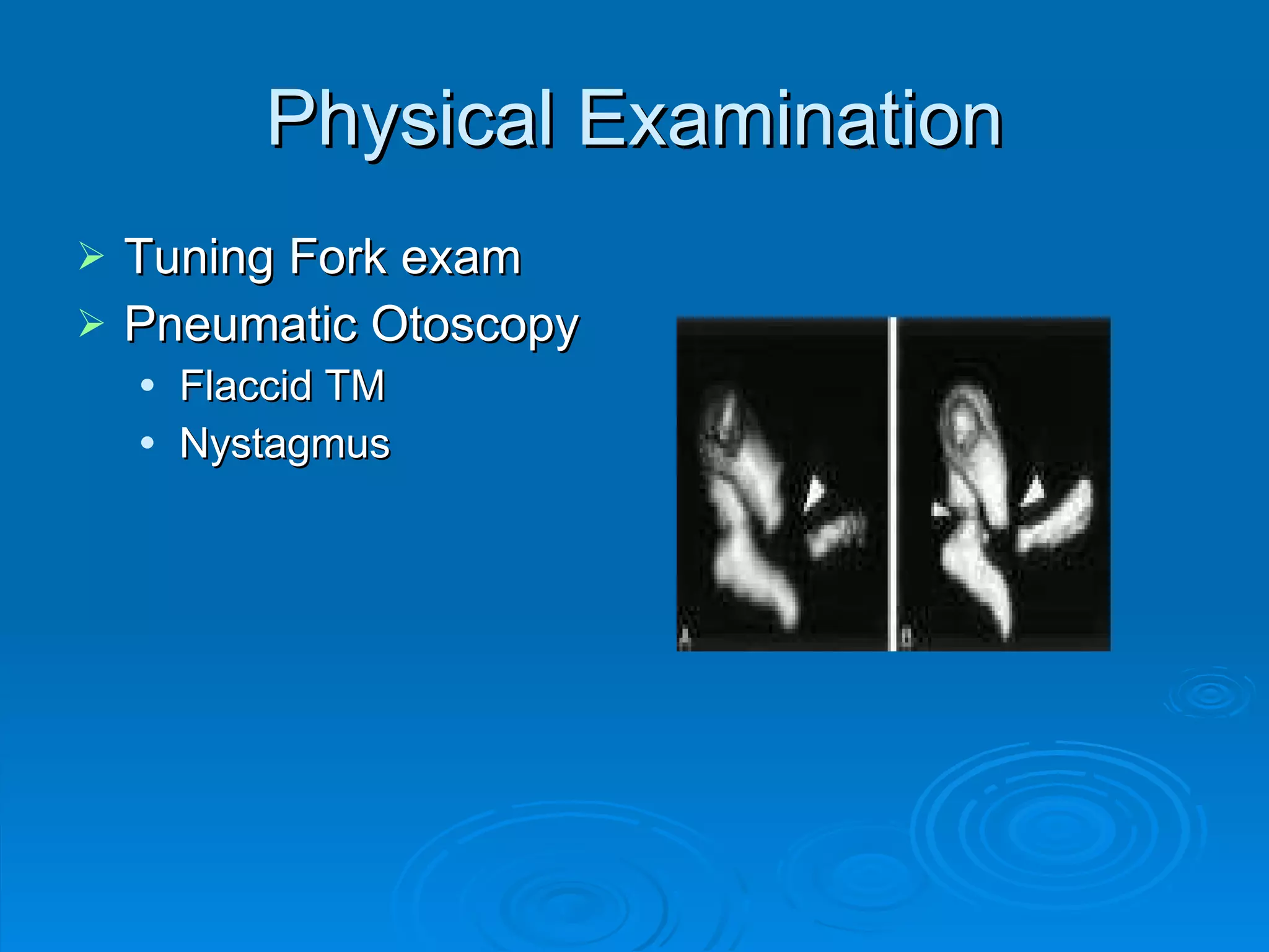 Physical Examination Tuning Fork exam Pneumatic Otoscopy Flaccid TM Nystagmus 