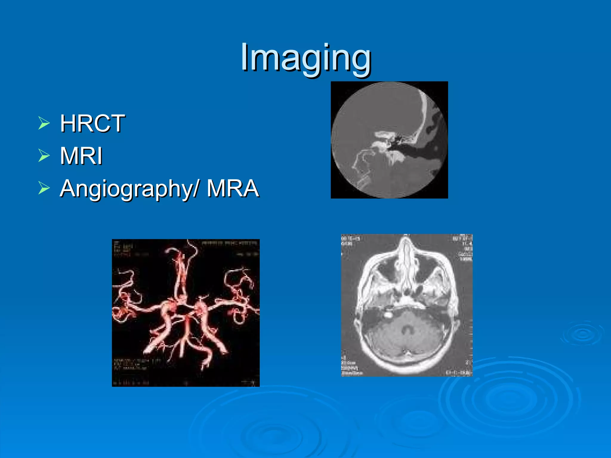 Imaging HRCT MRI Angiography/ MRA 