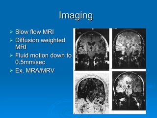 Imaging Slow flow MRI Diffusion weighted MRI Fluid motion down to 0.5mm/sec Ex. MRA/MRV 