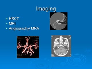 Imaging HRCT MRI Angiography/ MRA 