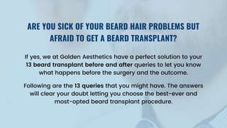 13 Things to Know about Beard Transplant to Get a Perfect Before and After  Look.pptx