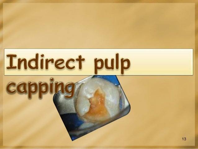vital pulp therapy direct pulp cap