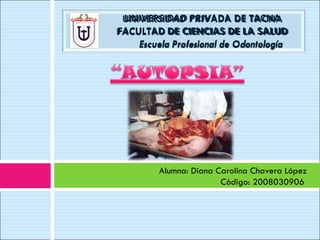Alumna: Diana Carolina Chavera López Código: 2008030906  UNIVERSIDAD PRIVADA DE TACNA FACULTAD DE CIENCIAS DE LA SALUD   Escuela Profesional de Odontología 