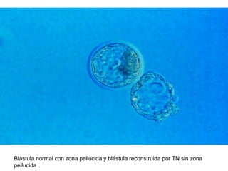 Blástula normal con zona pellucida y blástula reconstruida por TN sin zona
pellucida

 
