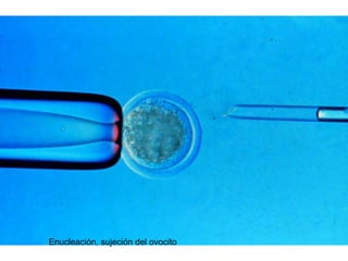Enucleación, sujeción del ovocito

 