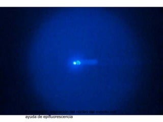 Enucleación, aspiración del núcleo del ovocito con
ayuda de epifluorescencia

 