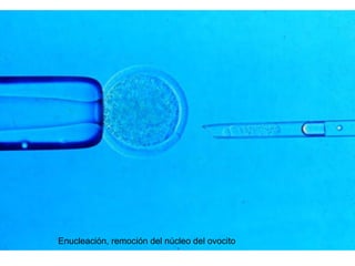 Enucleación, remoción del núcleo del ovocito

 