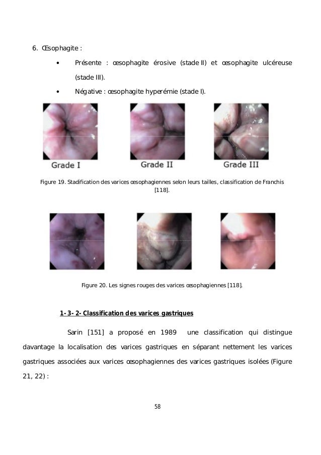 La chirurgie vasculeuse à g krasnodare