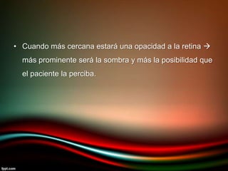 • Cuando más cercana estará una opacidad a la retina 
más prominente será la sombra y más la posibilidad que
el paciente la perciba.
 