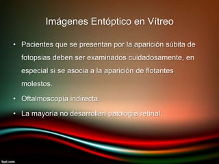 • Pacientes que se presentan por la aparición súbita de
fotopsias deben ser examinados cuidadosamente, en
especial si se asocia a la aparición de flotantes
molestos.
• Oftalmoscopía indirecta.
• La mayoría no desarrollan patología retinal.
Imágenes Entóptico en Vítreo
 