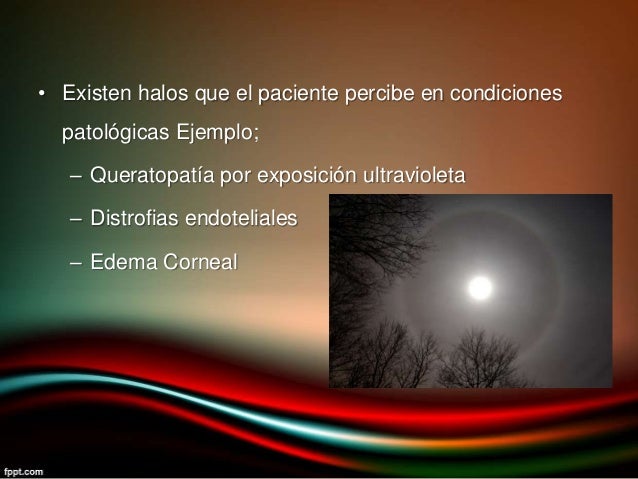 14. fenómenos entópticos