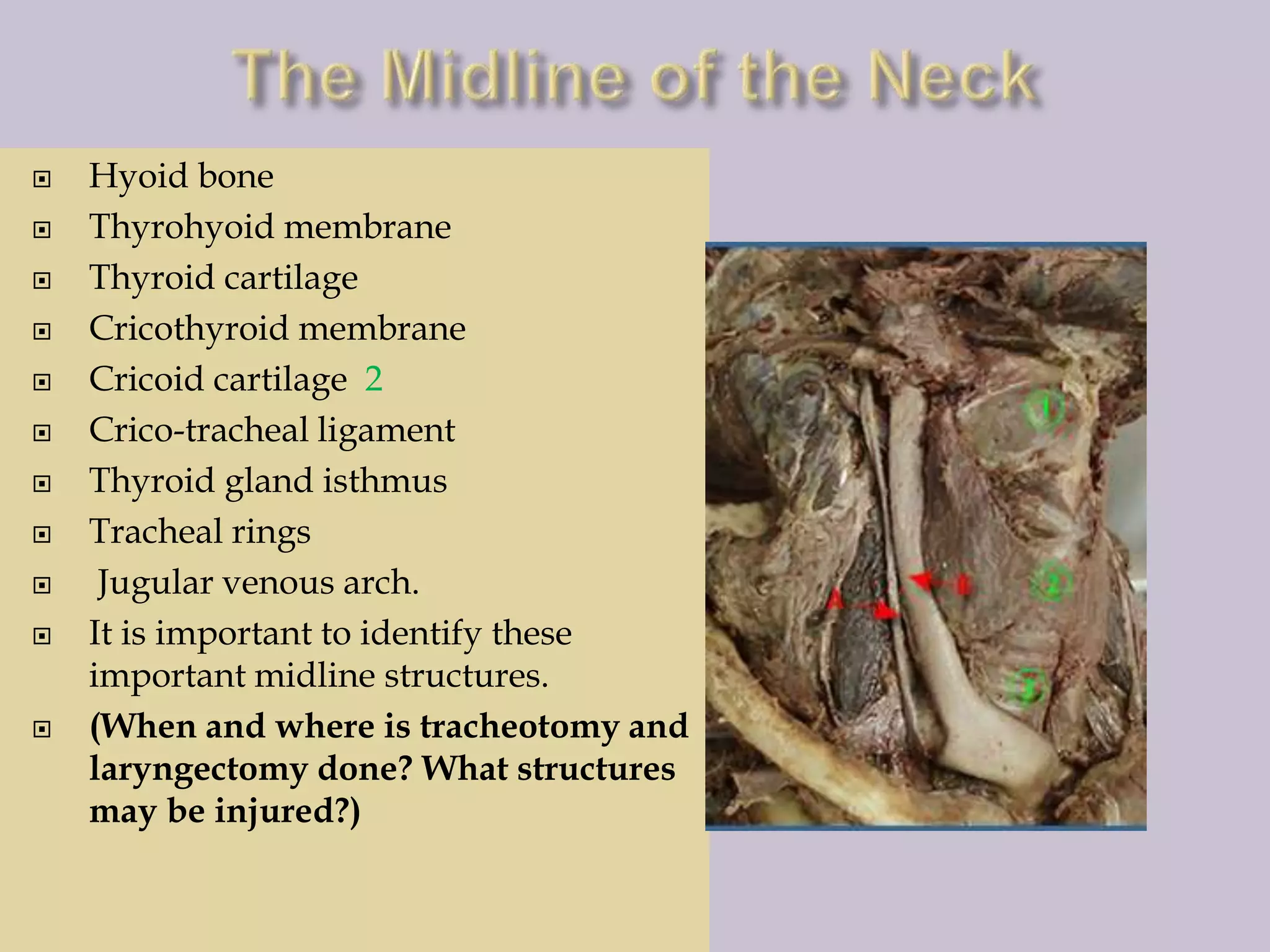 












Hyoid bone
Thyrohyoid membrane
Thyroid cartilage
Cricothyroid membrane
Cricoid cartilage 2
Crico-tracheal ligament
Thyroid gland isthmus
Tracheal rings
Jugular venous arch.
It is important to identify these
important midline structures.
(When and where is tracheotomy and
laryngectomy done? What structures
may be injured?)

 