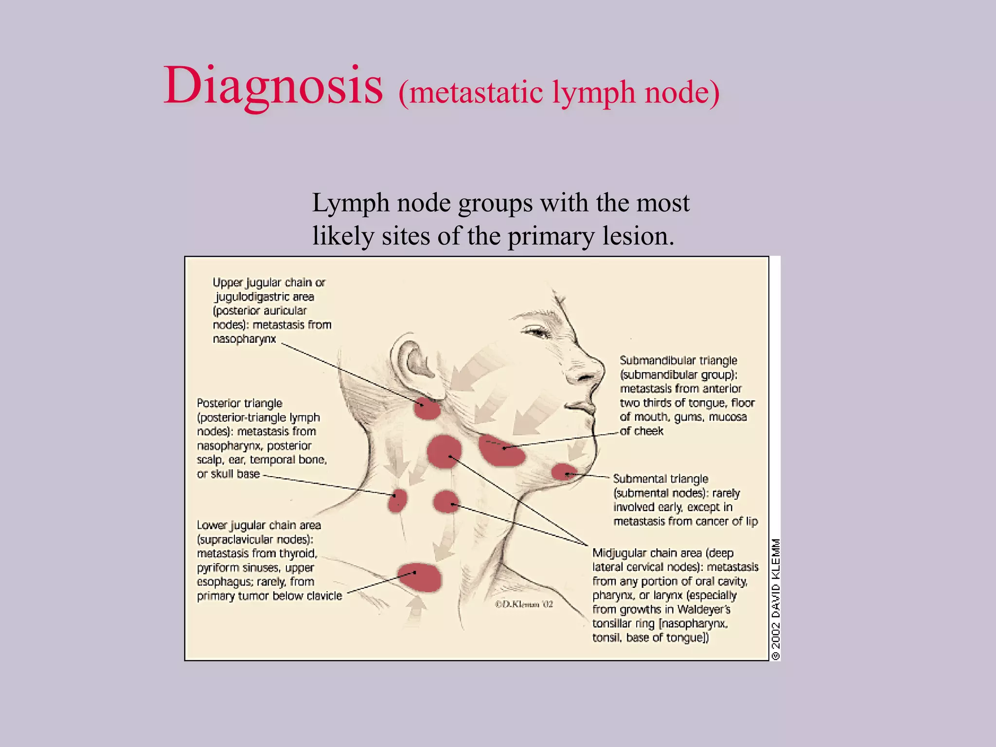 Diagnosis (metastatic lymph node)
Lymph node groups with the most
likely sites of the primary lesion.

 