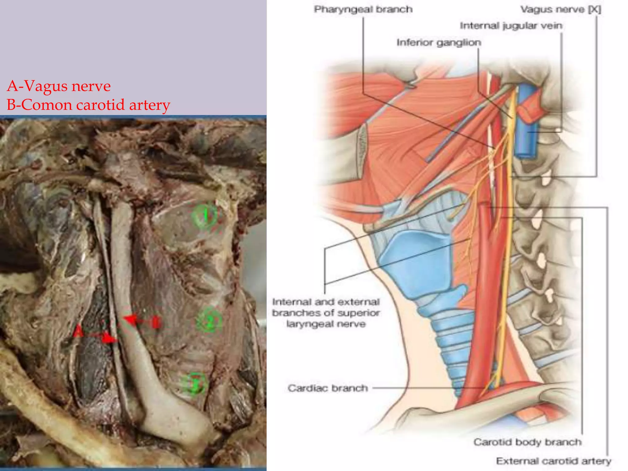 A-Vagus nerve
B-Comon carotid artery

 