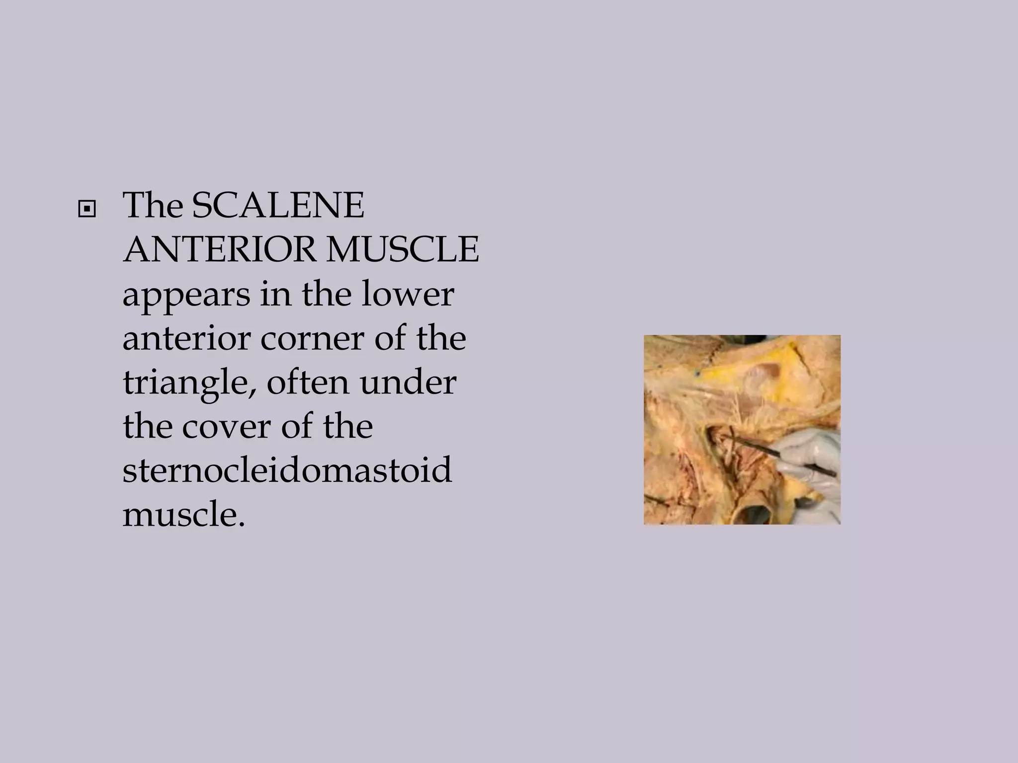 

The SCALENE
ANTERIOR MUSCLE
appears in the lower
anterior corner of the
triangle, often under
the cover of the
sternocleidomastoid
muscle.

 