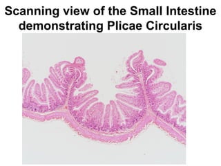 Scanning view of the Small Intestine
demonstrating Plicae Circularis

 