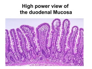 High power view of
the duodenal Mucosa

 