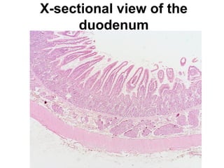 X-sectional view of the
duodenum

 
