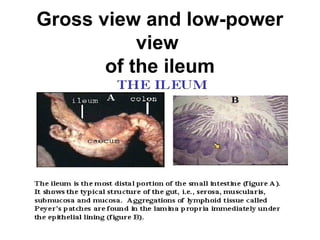 Gross view and low-power
view
of the ileum

 